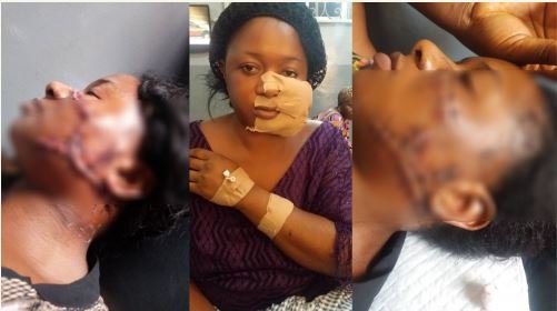 Landlord, Wife Cut Tenant’s Face Over Quit Notice (Read Full Details)